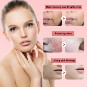 4-in-1 EMS Facial Beauty Device — Microcurrent, Vibration, Warm Massage & LED Light Therapy - Image 3